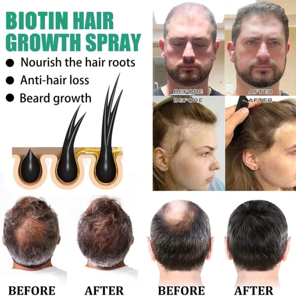 Anti Hair Loss Hair Nourishing Liquid Hair Firming And Hair Increasing - Image 3