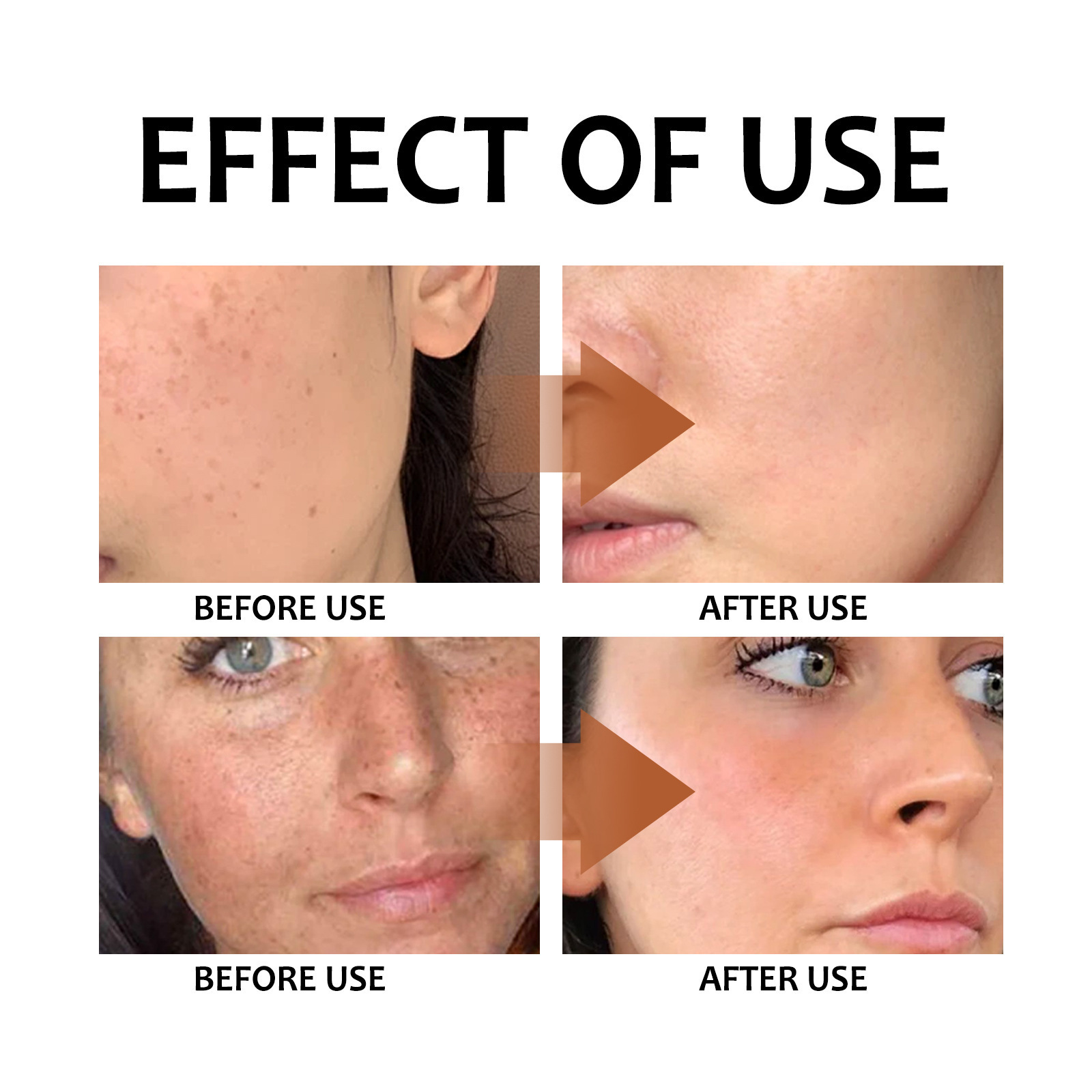 Lemon Turmeric Kojic Acid Soap Face Soap - Image 2