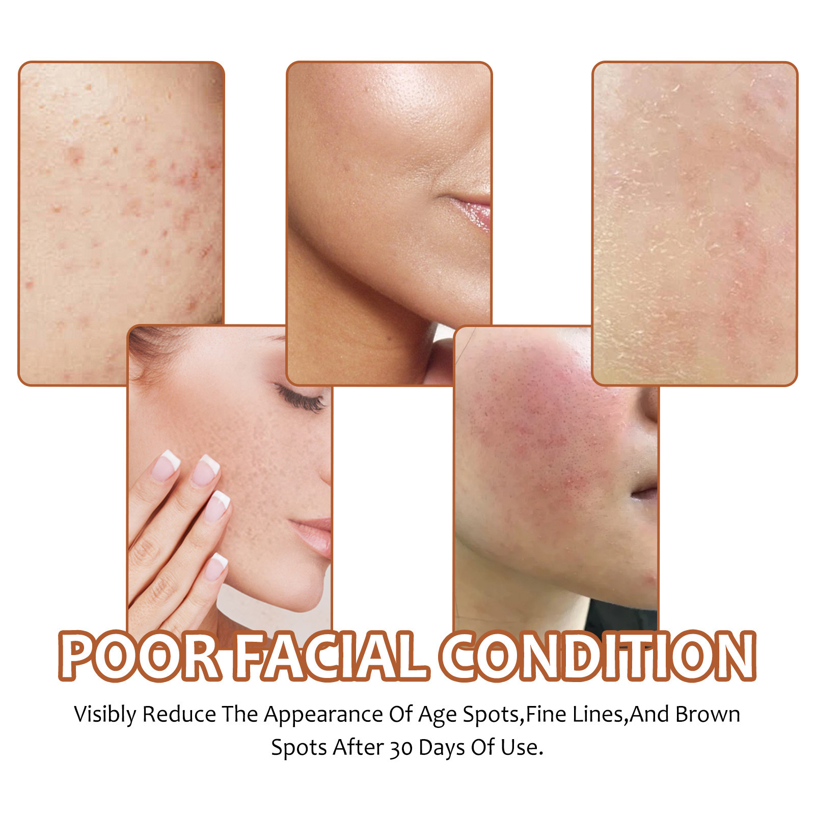 Lemon Turmeric Kojic Acid Soap Face Soap - Image 6