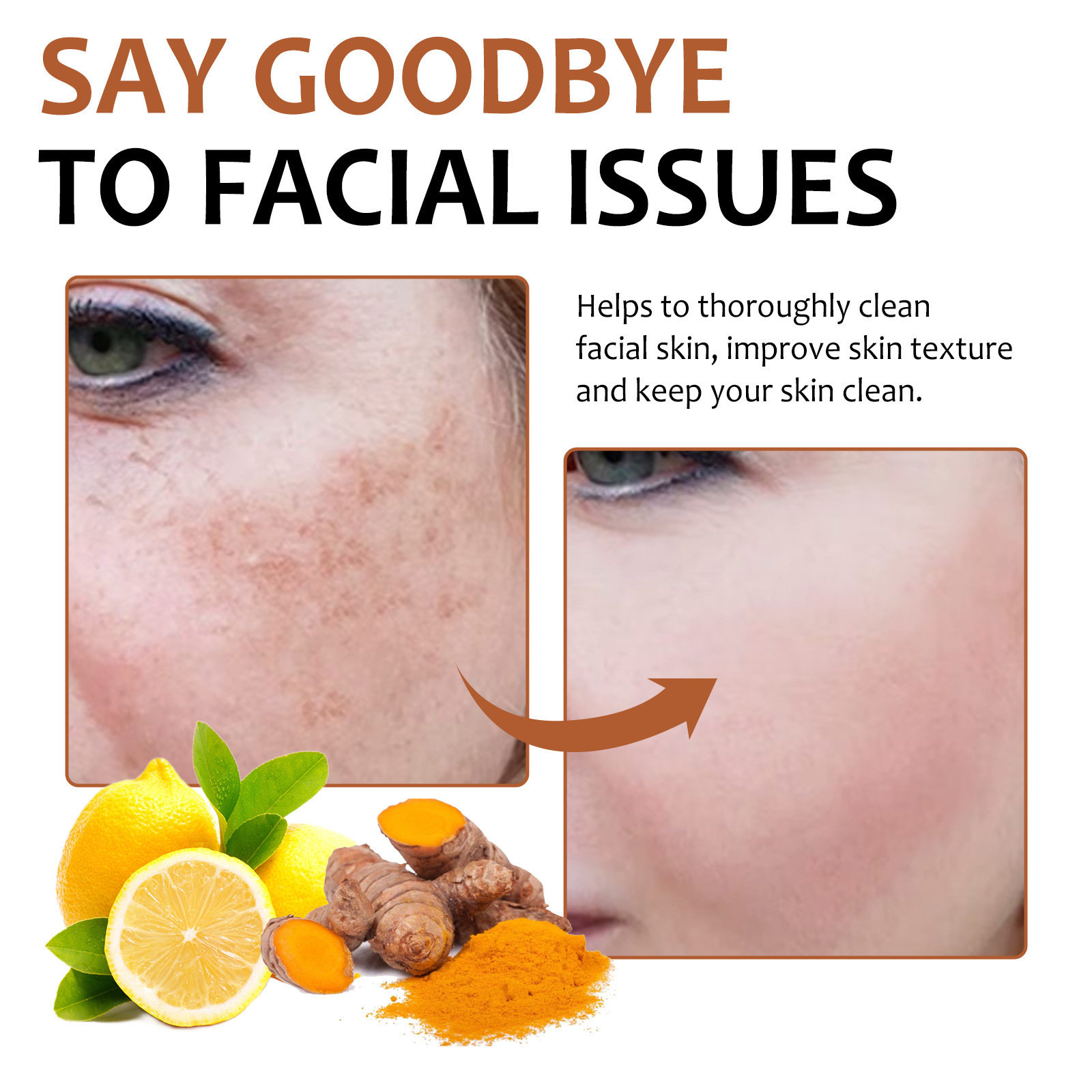 Lemon Turmeric Kojic Acid Soap Face Soap - Image 5